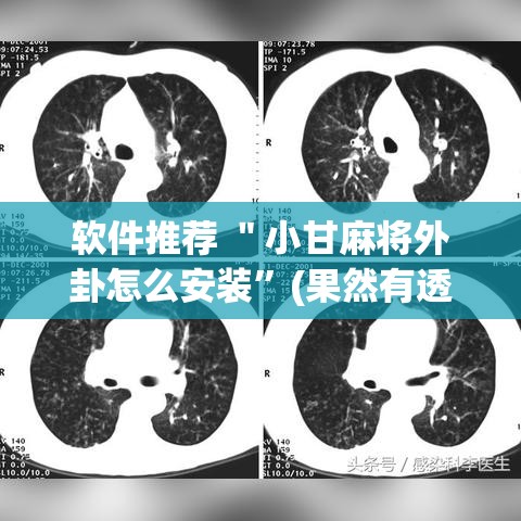 软件推荐 ＂小甘麻将外卦怎么安装”(果然有透视挂)