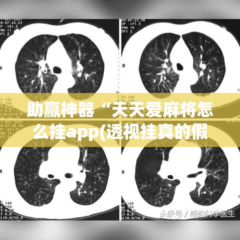 助赢神器“天天爱麻将怎么挂app(透视挂真的假的) 助赢神器“天天爱麻将怎么挂app(透视挂真的假的)